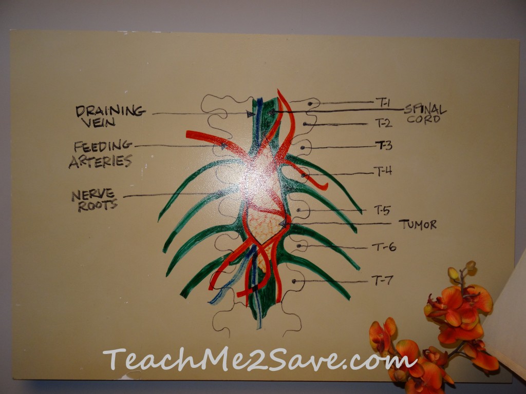 Grey's Anatomy Spinal Cord Pic